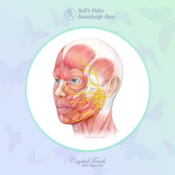 How does Bell's palsy happen