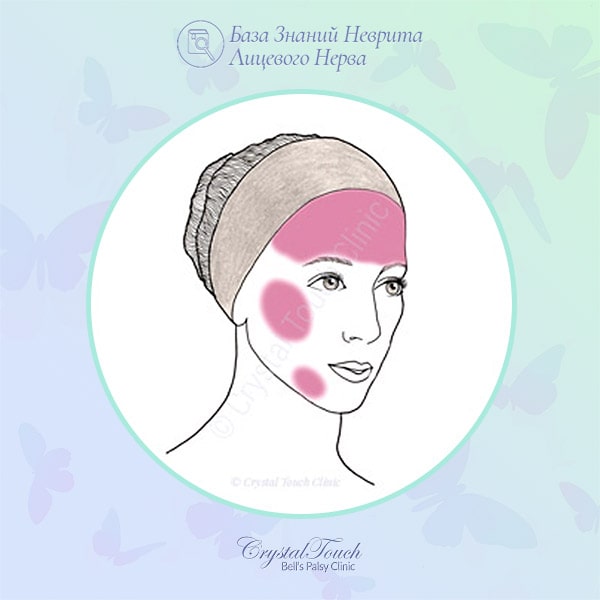 Хроническая боль и спазмы лица после невропатии лицевого нерва