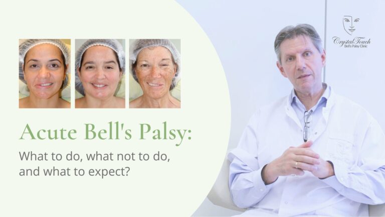 Acute Bell's palsy