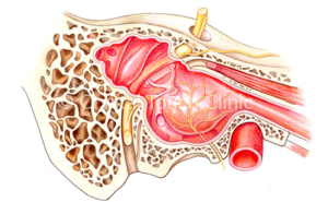 Facial nerve in temporal bone channel