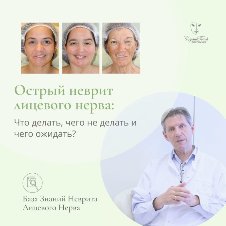 Острый Неврит Лицевого Нерва - что делать, чего не делать, и чего ожидать