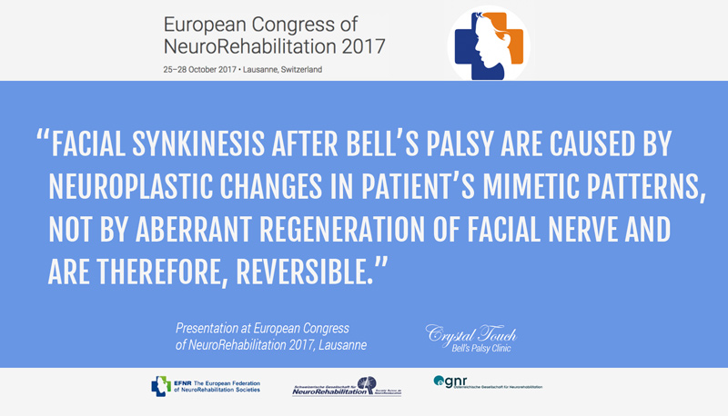 ECNR 2017 Crystal Touch