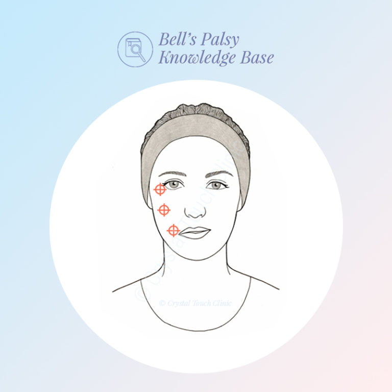 selective neurolysis for synkinesis