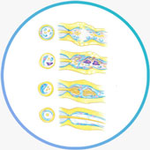 Bell's Palsy Video Lectures Episode 2