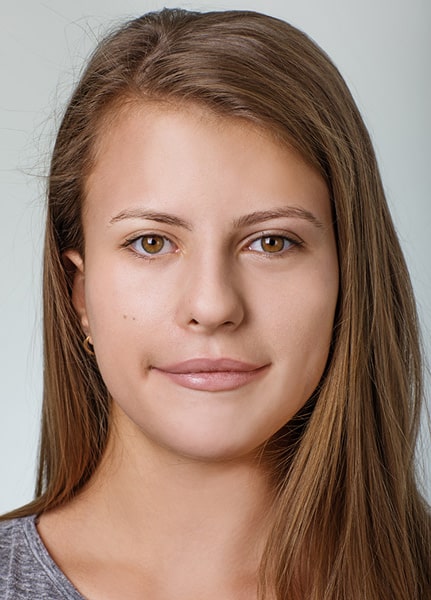 Алина - восстановление после врожденного неврита лицевого нерва