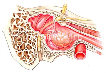 Facial nerve in the pyramid of temporal bone