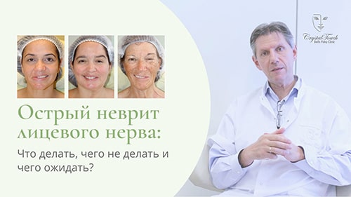 Острый неврит лицевого нерва - что делать и чего ожидать