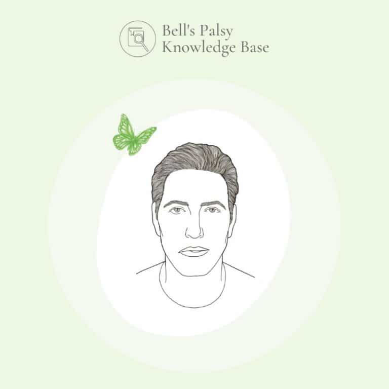 What is Ramsay Hunt Syndrome